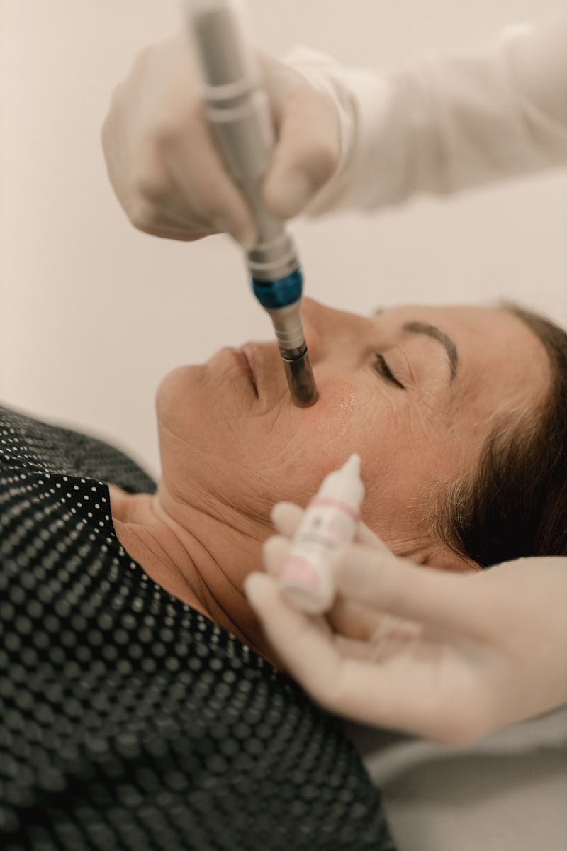 Dermatologist performing acne treatment